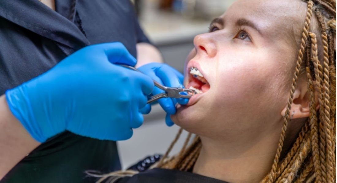 Fixing Grinded Teeth