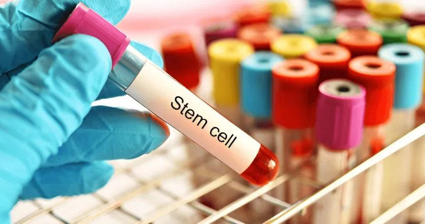  Stem Cell Therapy