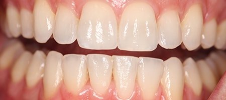 The Training Courses Driving Success in the Whitening Industry